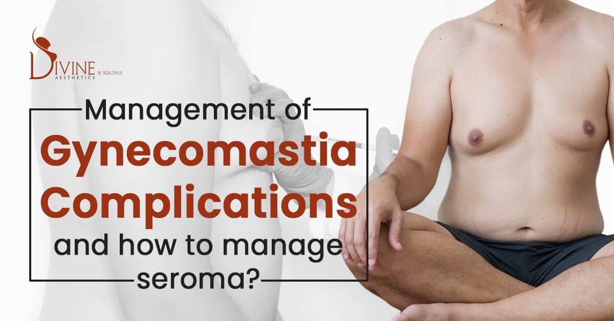 How to Manage Complications After Gynecomastia and Seroma