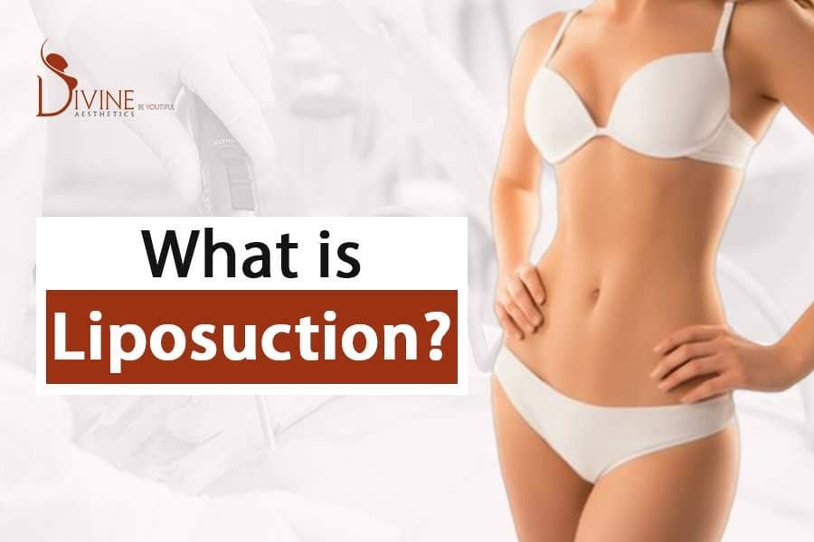 What is Liposuction? Is There Any Risk in Liposuction Surgery?