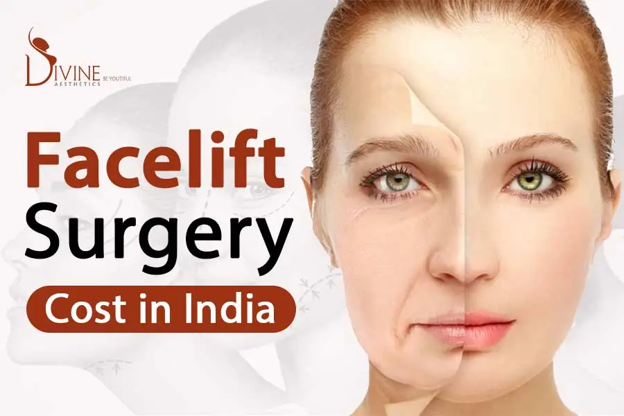 https://www.divinecosmeticsurgery.com/wp-content/uploads/2022/10/Facelift-Cost-in-India.webp