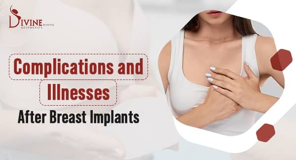 This Woman's Breast Implants Caused Her To Collapse