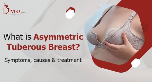 Asymmetric Tuberous Breast : Symptoms, Causes & Treatment