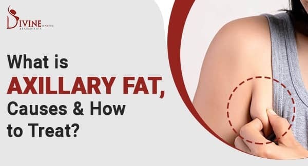 What Causes Armpit Fat And How To Get Rid Of It? - BetterMe