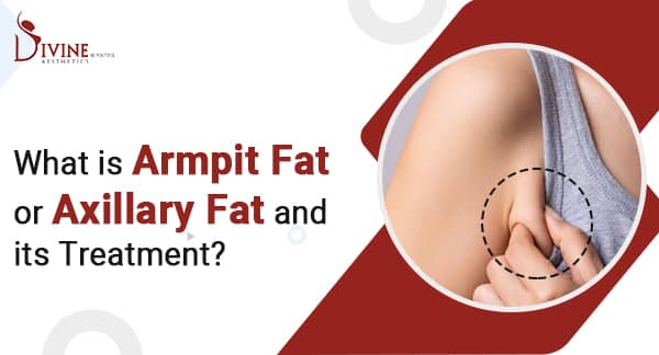 How to Reduce Armpit Fat? Axillary Breast Treatment in India
