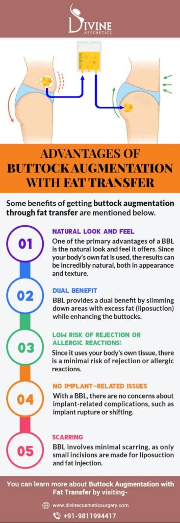 Advantages of Buttock Augmentation with Fat Transfer
