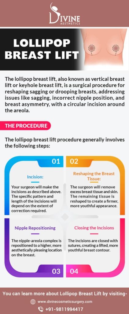 Lollipop Breast Lift