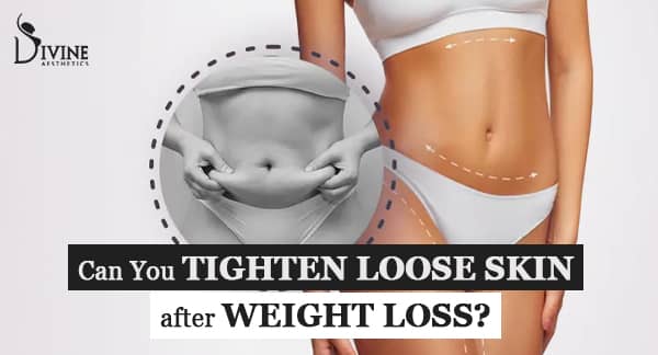Tips for How to Tighten Saggy/Loose Skin: What You Need to Know