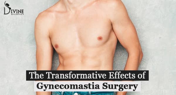 Puffy Nipples or Gyno? Know the Difference and Best Treatment