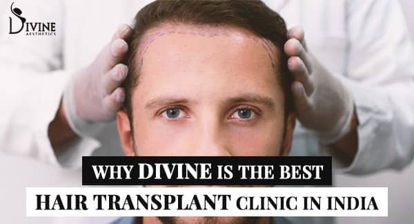 best hair transplant clinic in India